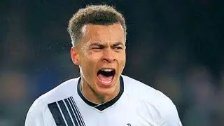 DELE ALLI SLAPPED BY ERIC DIER ON A LIVE INTERVIEW ON TV.. he is gonna pay