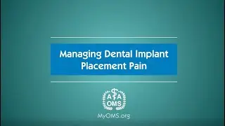 Managing Dental Implant Placement Pain