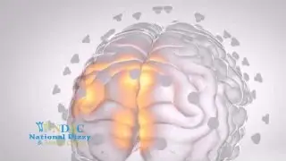 Commercial Brain Network Activation (BNA)