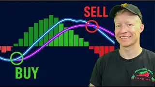 The BEST MACD Scanner in ThinkorSwim 2025