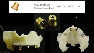 Blue Sky Bio Super Snap Overdenture Housings