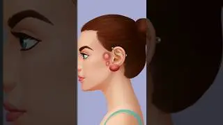 ASMR Big Acne removal Ear Animation  #shorts #blackheads#asmr