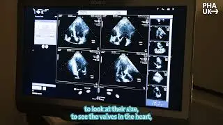 Understanding echocardiogram (echo) tests