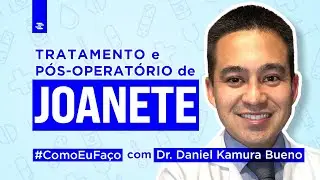 Como Eu Faço: Tratamento e Pós-Operatório de Joanete com Dr. Daniel Kamura Bueno