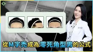 從M字禿成為零死角型男的公式｜植髮案例分享｜生髮植髮專家黃怡婷醫師