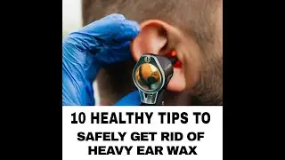 👂🏽Secret Tips for Safe Ear Wax Removal🕯 #earwax #earwaxremoval