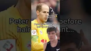 Peter Gulacsi hair transplant 🔥 #hairtransplant #football