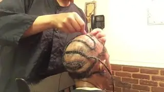 HAIR LOSS SEW IN