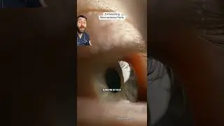 You&rsquo;re Blind For Up to 2hrs a Day? Doctor Explains