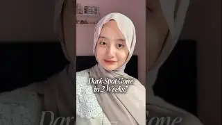 Dark Spot Memudar dalam 2 Minggu?! 😳✨ #axisy #darkspotserum #darkspotcare #darkspotcorrector #shorts