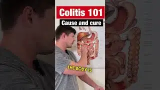 Colitis - Holistic Protocol