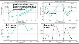 Left Atrium - Pressure - Volume changes through a cardiac cycle.