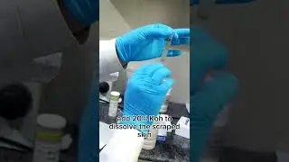 Koh stain for fungus skin scraping