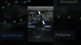 Ultrasound of the Pylorus in a dog