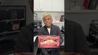 Why does insurance cover extractions but not implants?🦷