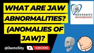 Abnormalities of jaw