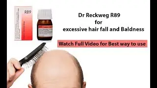 Homeopathic medicine for Baldness | best medicine for baldness | How to use R89 |  Dr reckeweg R89