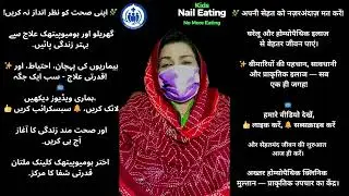 19  Nails Eating Treatment | Stop Nail Biting Naturally | Homeopathic & Natural Remedies #nailseat