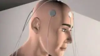 EMIT 1