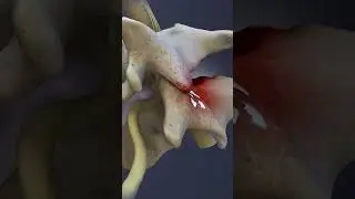 Spinal Conditions of the C6-C7 Spinal Motion Segment