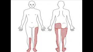 Dysesthesia Abnormal Sensation Due to Nerve Damage  ; Definition, Causes, Symptoms, Diagnosis, Treat