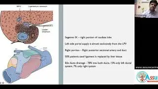 SURGICAL GASTRO/ HPB by Dr Prithiviraj @ ASSURE - Liver anatomy (Model class)