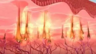 Soprano Ice - Laser Hair Removal