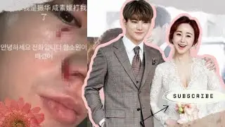 Korean Celebrity Jin Hua Reveals 8 Years of Domestic Abuse by Wife Ham So Won on Instagram
