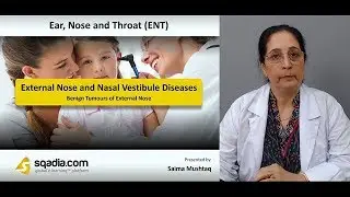 External Nose and Nasal Vestibule Diseases | Benign Tumours of External Nose | Medical Student