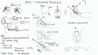 Airway Management 2 - Intubation