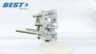 Transparent Resin Spine Model with Interbody Cage and Pedicle Screw System
