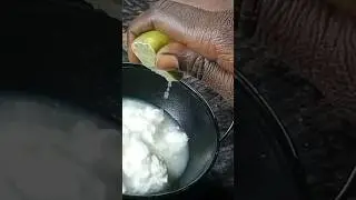 Instant Home Remedy for Stubborn Dandruff, a common concern in Winters