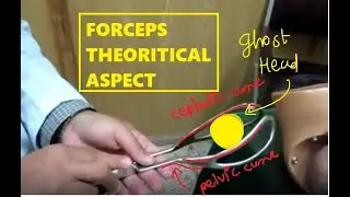 FORCEPS  IN OBSTETRICS- ALL YOU NEED TO KNOW