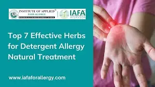 Top 7 Effective Herbs for Detergent Allergy Natural Treatment