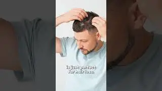 HAIR LOSS: SHOULD YOU REALLY BLAME IT ON GENETICS?
