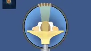 Computed Axial Tomography (CAT) Scan