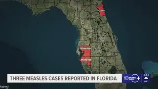 Florida Department of Health reports 3 new cases of measles
