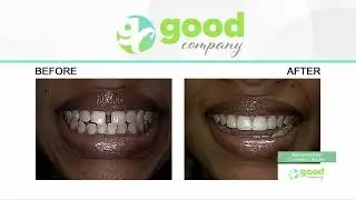 Achieving Joy and Confidence in Your Smile | Dr. Steve Marsh