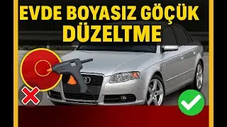 Boyasız Göçük Düzeltme Deneyleri: Silikon Yöntemi Efsane mi Gerçek mi?