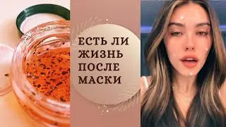 ЦЕЛЫЙ ГОД ПОЛЬЗОВАЛАСЬ КОСМЕТИКОЙ NIVEA, что произошло с кожей.