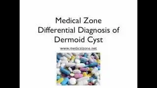 Medical Zone -  Differential Diagnosis of Dermoid Cyst