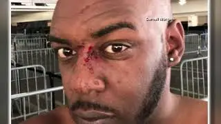 Las Vegas tourist fights homophobic attack with love