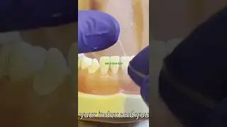 How to use dental floss (c-shape flossing demo) #dentist #floss #dentalhygiene