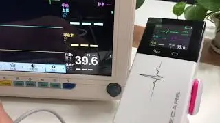Patient Monitor 3-Vecare
