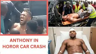 Anthony Joshua Seriously Injured in Car Accident Following Jake Paul Fight