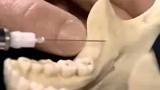 YouTube   ID block anatomy  model