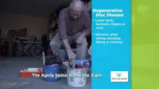 Art fo Aging: The Aging Spine