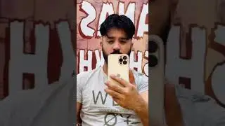 Anas Sheikh Hair Solution | Short Video Hair Patch | Hair Patch For Men | Call us 9650914665