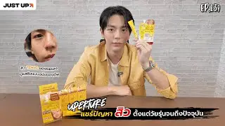 Uperture EP.137 | แชร์ปัญหาสิวตั้งแต่วัยรุ่นถึงปัจจุบัน / สิว TOXIC ของผมเอง / ดูแลผิวแบบฉบับของอัพ