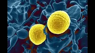 2, 34, 66,79, 102 Hz : Staphylococcus (RIFE Healing Frequency)